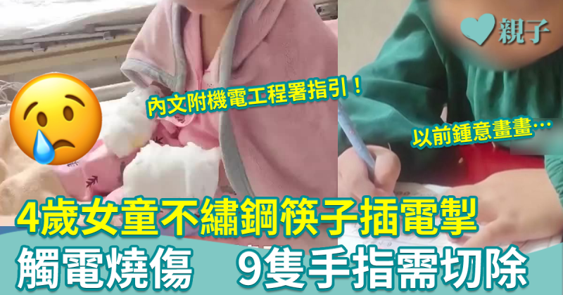 家居意外︳4歲女童不繡鋼筷子插電掣觸電燒傷　9隻手指需切除