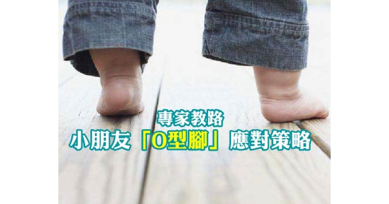 【專家教路】小朋友「O型腳」應對策略