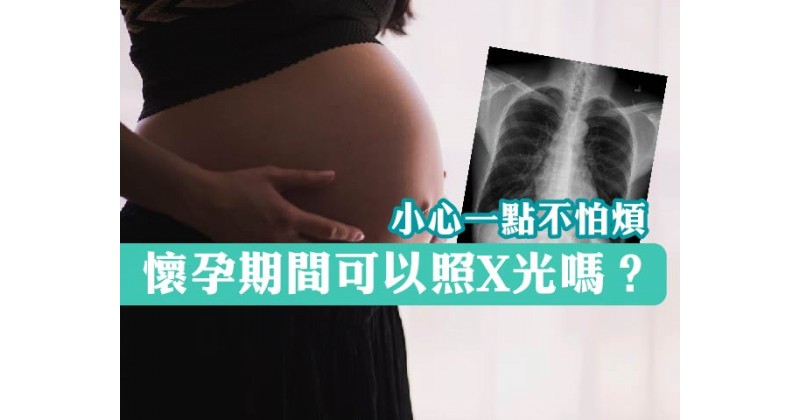 【小心一點不怕煩】懷孕期間可以照X光嗎？