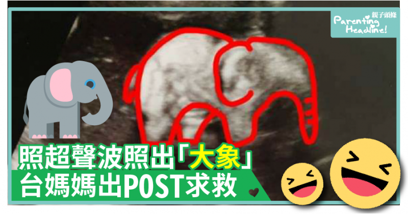 【爆笑】照超聲波照出「大象」　台媽媽出post求救