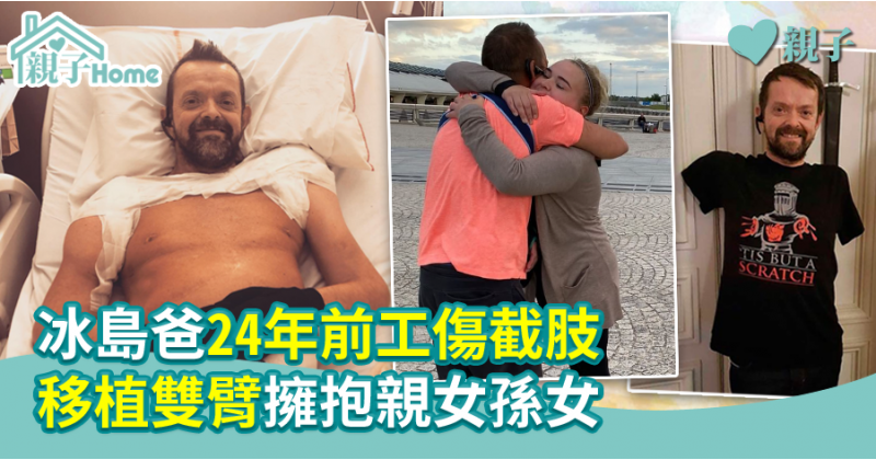 【親子頭條】冰島爸24年前工傷截肢  移植雙臂擁抱親女孫女