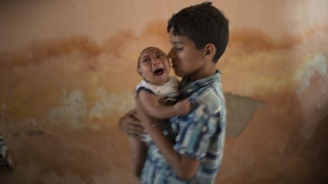 【3千嬰兒感染】巴西爆發細頭症